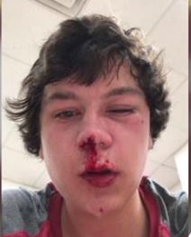 shley Williams Marble photo of son injuries - Wakefield High - WCPSS
